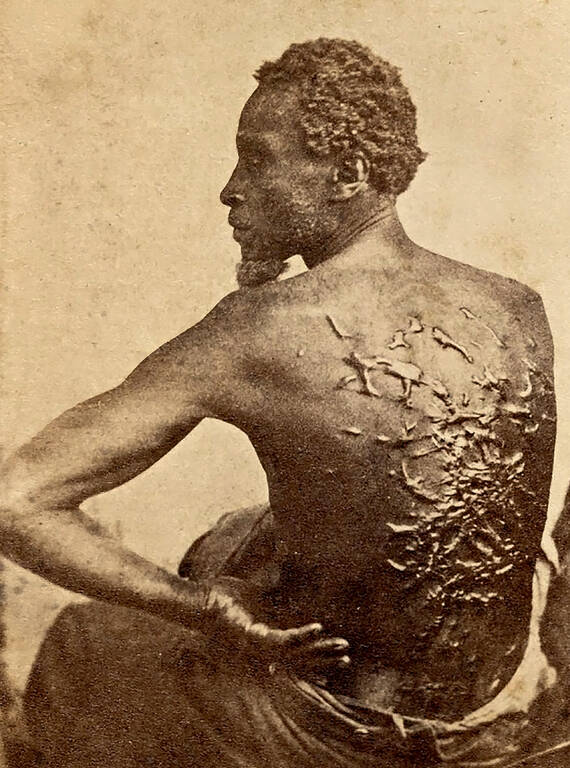 <p>“The Scourged Back,” which vividly shows the horrors of slavery, is among the works the current administration has targeted for removal from a park site, according to The Washington Post.</p>